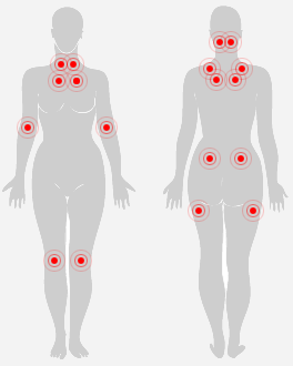 Fibromyalgie | allnatura France